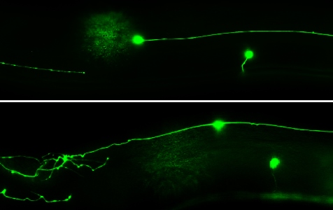 Les neurones dépourvus de la DIP-2 (bas) ont une forme différente des neurones normaux (haut). Courtoisie : Nathaniel Noblett et Antonio Colavita